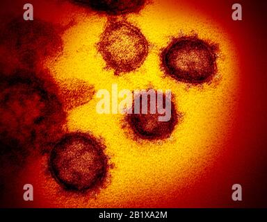 COVID-19. Novel Coronavirus SARS-CoV-2.This transmission electron microscope image shows SARS-CoV-2—also known as 2019-nCoV, the virus that causes COVID-19. isolated from a patient in the U.S., emerging from the surface of cells cultured in the lab. Credit: NIAID-RML Stock Photo