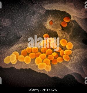 Novel Coronavirus SARS-CoV-2  COVID-19. This scanning electron microscope image shows SARS-CoV-2 (orange)—also known as 2019-nCoV, the virus that causes COVID-19—isolated from a patient in the U.S., emerging from the surface of cells (gray) cultured in the lab. Credit: NIAID-RML Stock Photo