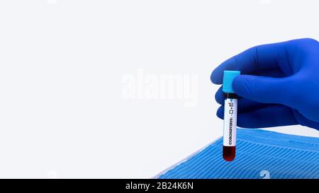 Nurse holding a positive blood test result for the new rapidly spreading Coronavirus COVID-19. Coronavirus blood test concept with copy space. Stock Photo