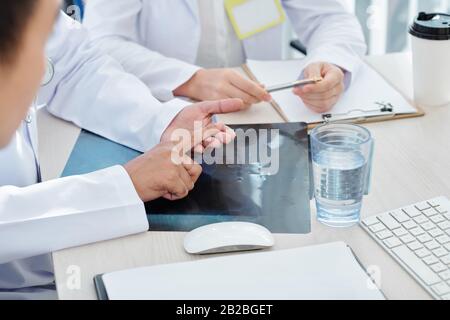 Lungs x-ray on desk of medical workers discussing difficult case of pneumonia Stock Photo