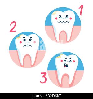 Step of gum disease flat cartoon illustration Stock Vector