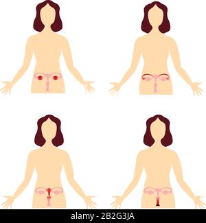 Diseases of the female reproductive system. Scheme of the human body. Anatomical image. Stock Vector