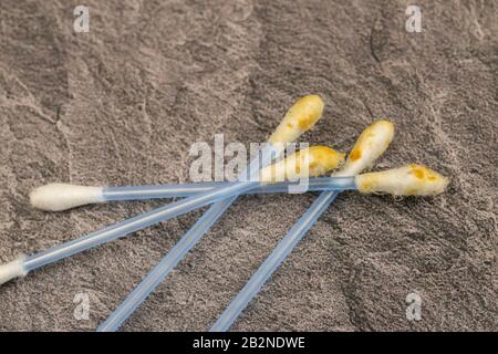 Used blue dirty cotton swabs with earwax, Germany Stock Photo