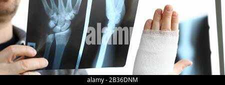 Male patient hold in hand CT scan of his broken arm Stock Photo