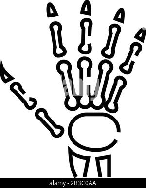 wrist,hand,calcium,structure,arm,carpus,health,xray,finger,injury ...