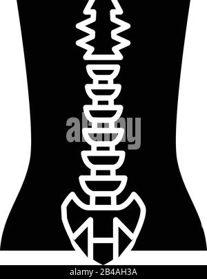 https://l450v.alamy.com/450v/2b4ah3a/spine-bone-structure-black-icon-concept-illustration-vector-flat-symbol-glyph-sign-2b4ah3a.jpg