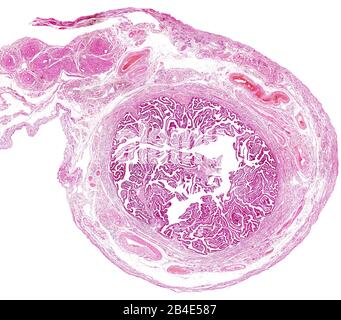 Cross section of a human fallopian tube. The innermost layer is a very folded mucosa. Outside are located the muscular layer and the serosa layer, sho Stock Photo