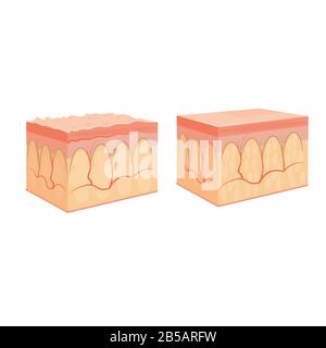 wrinkle and normal skin cross-section of human skin layers structure ...