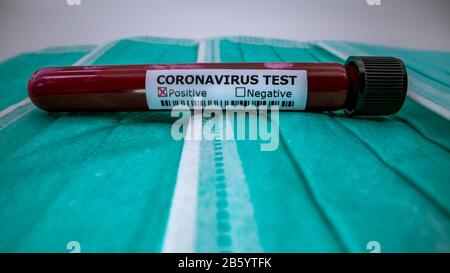 Protective mask and positive COVID-19 test. Laboratory sample of blood testing for diagnosis new Corona virus infection. Disease 2019 from Wuhan. Pand
