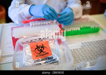 Lab technicians handle suspected COVID-19 samples as they carry out a diagnostic test for coronavirus in the microbiology laboratory inside the Specialist Virology Centre at the University Hospital of Wales in Cardiff. Stock Photo