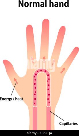 Normal hand blood circulation illustration Stock Vector