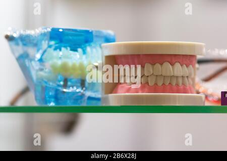 Dental layout of the human jaw with teeth and implants Stock Photo - Alamy