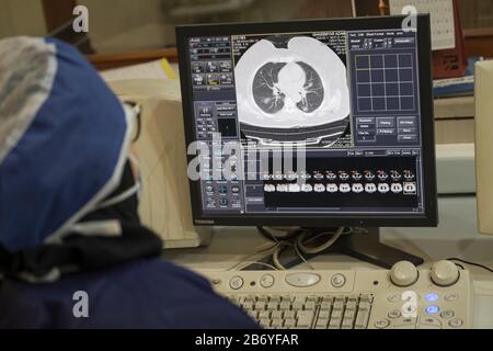 Tehran, Iran. 12th Mar, 2020. Iranian medical personnel wearing protective gear, checks a scanned image of the lungs of a patient as she works at a CT Scan section of the Rassolakram hospital in western Tehran following a new coronavirus (Covid-19) outbreak in Iran March 11, Photo by Morteza Nikoubazl/UPI Credit: UPI/Alamy Live News Stock Photo