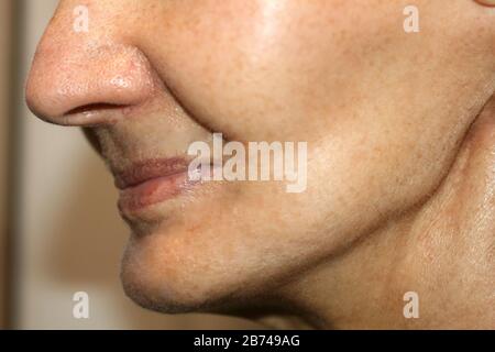 Nasolabial wrinkles. Wrinkles on the skin of the face of the neck ...