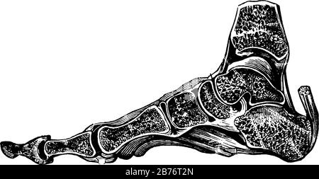 A typical representation of the section through the bones and ligaments of the foot. The parts of the joints are well shown, vintage line drawing or e Stock Vector