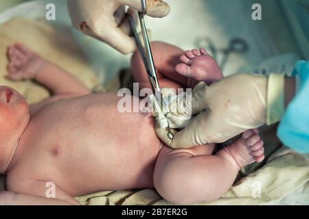 Close-up doctor obstetrician nurse cutting umbilical cord with medical scissors to newborn infant baby. Medical surgeon giving birth to child. New Stock Photo