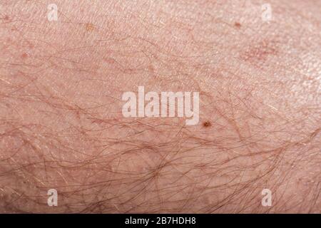 very hairy men's skin Stock Photo - Alamy
