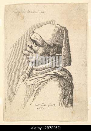 Bust of a deformed man with a hat and a fat, protruding lower lip in profile to left, 1625-77. Stock Photo