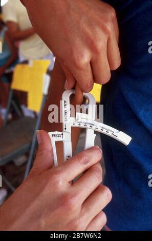 Skinfold Body Fat Test. Measuring Body Fat on Subscapular Tissue