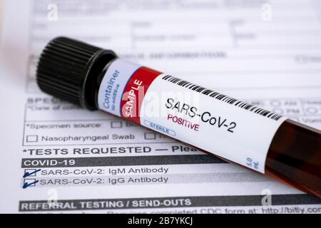 Testing for presence of coronavirus. Tube containing a blood sample that has tested positive for COVID-19. Test form in the background. Stock Photo