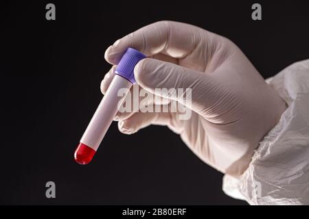 Male doctor's hands in white protective clothing and medical gloves holding blood sample Stock Photo