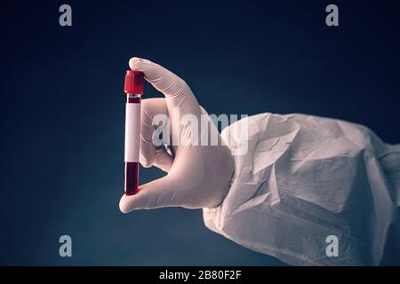 Hand holding test tube with blood plasma ready for testing Stock Photo