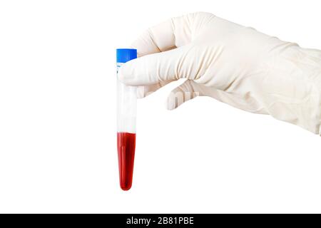 A hand holding a vacuum venipuncture test tube isolated on a while background. Checking the blood test for viruses. The study of the DNA of the person Stock Photo