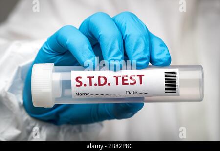 STD swab test Stock Photo
