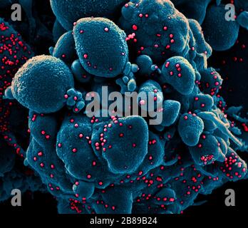 A transmission electron micrograph of COVID-19, novel coronavirus, an apoptotic cell heavily infected with SARS-COV-2 virus particles, isolated from a patient sample at the NIAID Integrated Research Facility March 18, 2020 in Fort Detrick, Maryland.