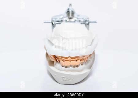 Plaster Cast of jaws. Dental casting gypsum model human Jaws in prosthetic laboratory. Dentistry, Orthodontics. Close up. selective focus Stock Photo