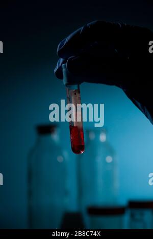 Hand of researcher holds test tube with blood for Coronavirus 2019-nCOV test. blood test result for the new rapidly spreading Coronavirus Stock Photo