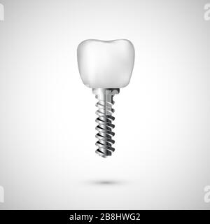 White realistic tooth implant illustration. Dentist care and tooth restoration medicine background on white background. Vector Stock Vector