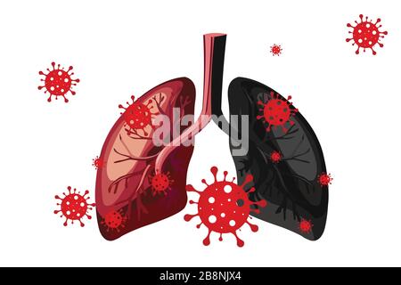 Coronavirus cell in human lungs on white backgrounds Stock Vector