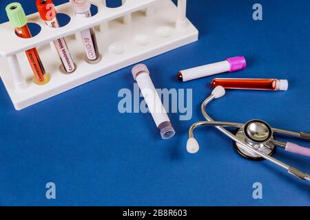 Blood sample for the new rapidly spreading Coronavirus that originated in covid-19 epidemic outbreak Stock Photo