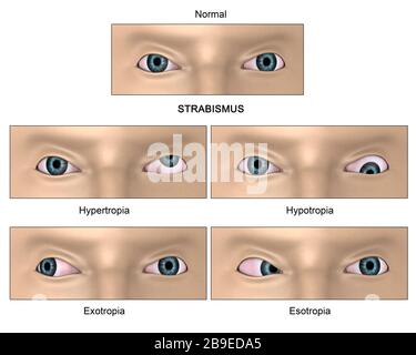 Human eye vision chart and sight medical optometrist symbol for the ...