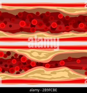 artery set with blood cells Stock Vector