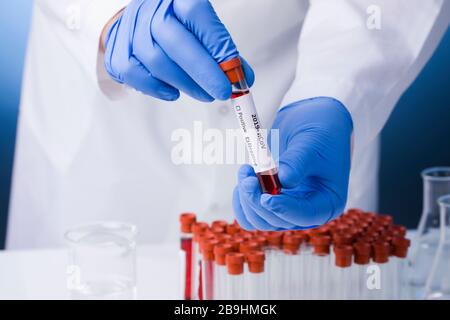 Laboratory testing patient’s blood samples for presence of coronavirus (COVID-19): A hand holds a test tube containing a blood sample that has tested Stock Photo