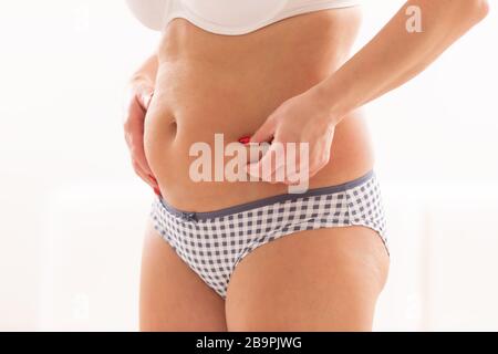 obese woman holding her own belly to control fat obesity and cellulite Stock Photo