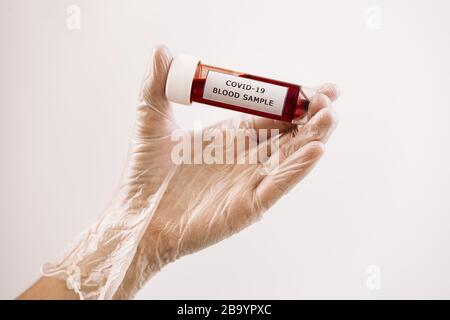 gloved hand taking a vial of blood sample infected with covid-19, medicine concept and protection against viruses and bacteria Stock Photo
