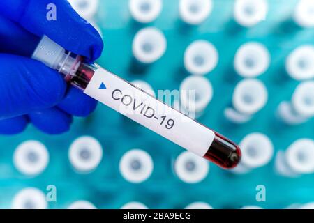 Positive results of corona virus tests. Many blood test tube in special holder in the laboratory. Stock Photo