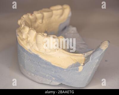 Model of plaster cast of lower teeth of human against dark background Stock Photo