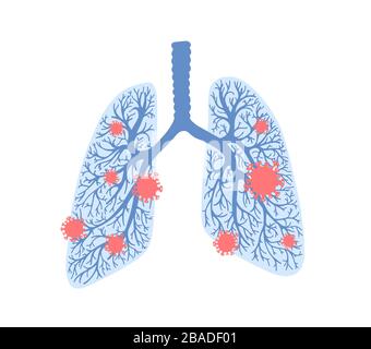coronavirus damaged human lungs, pandemic covid-19 Stock Vector