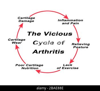 Steps in Vicious Cycle of Arthritis Stock Photo - Alamy