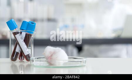 Blood collection tubes from covid 19 patients on a white laboratory table. Stock Photo