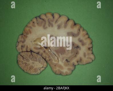 human brain sliced with nerves Stock Photo