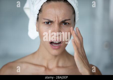 Woman touches face feels stressed about first mimic wrinkles Stock Photo