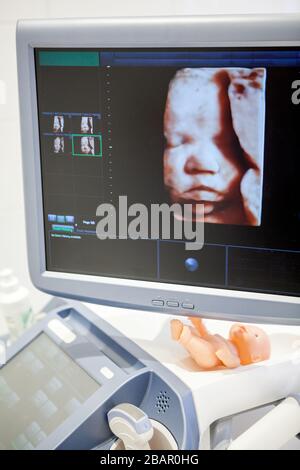 Model of image of mature fetus is on ultrasonographer monitor screen, face of baby, close up view Stock Photo