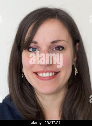 Heterochromia. Young caucasian woman with different colored pupils poses on white background. Brown and blue. Stock Photo