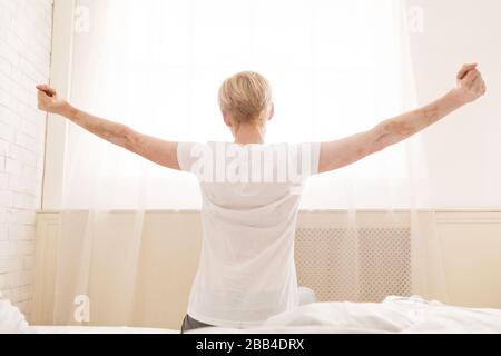 Back view of woman with vitiligo stretching in the morning Stock Photo