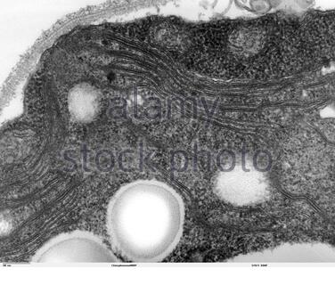 Transmission electron microscope showing mitochondria Stock Photo ...